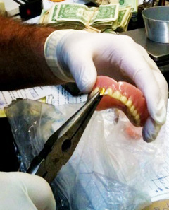 Where to sell dental gold in Chicago, IL - Royal Jewelers & Loans